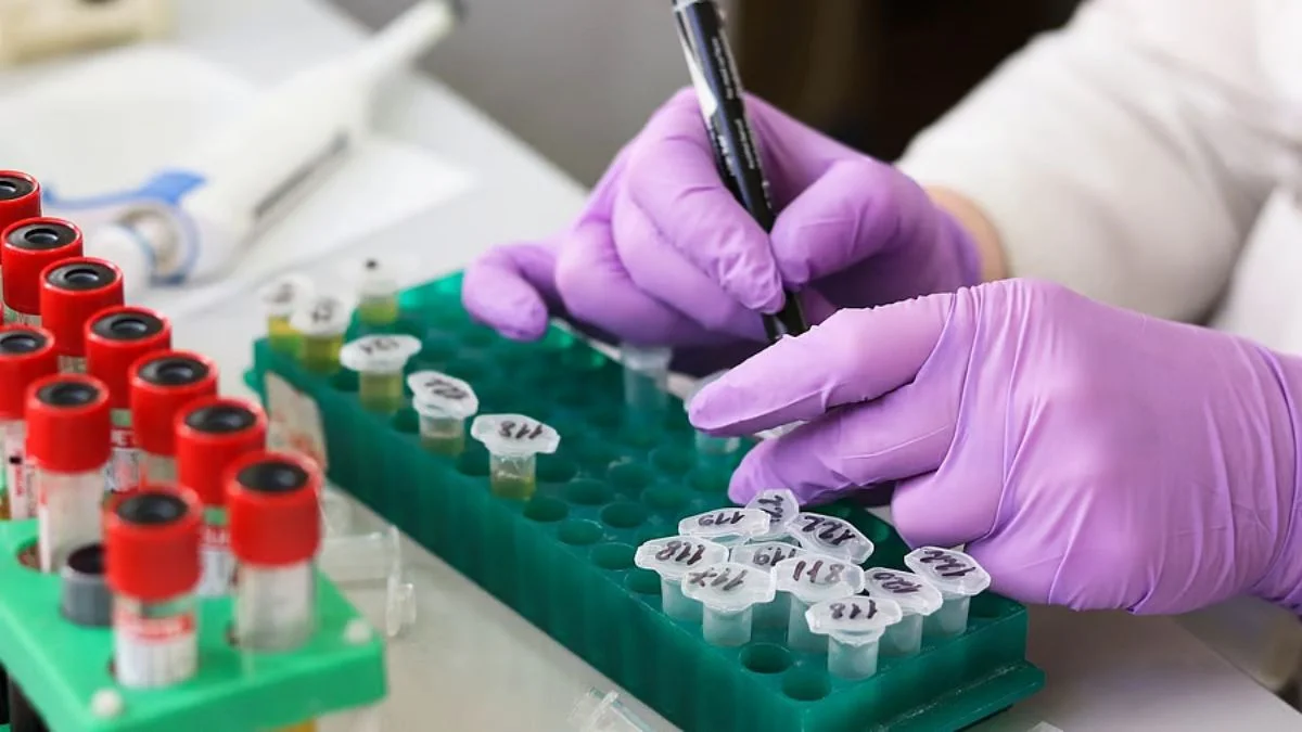 Doping: डोप टेस्ट में फंसे पहलवान विक्रांत सिंह ने लिया एशियाई चैंपियनशिप के ट्रायल में हिस्सा Doping Scandal